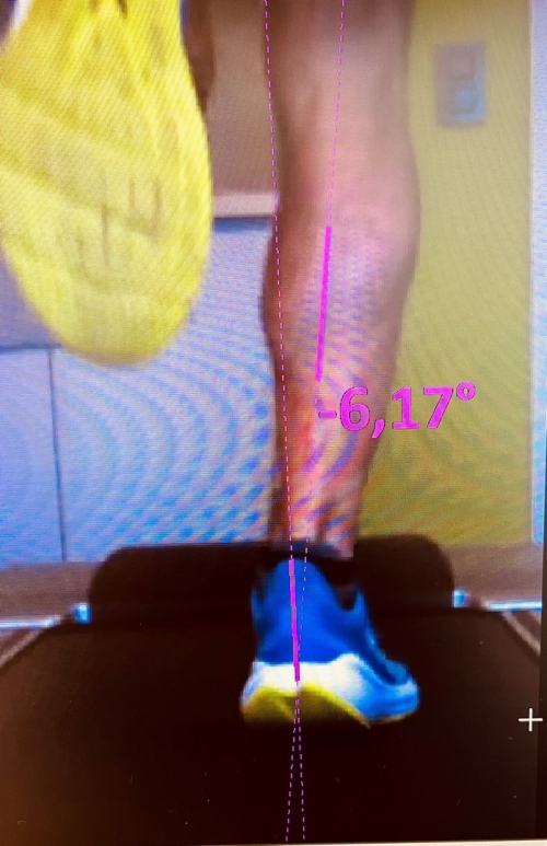 Loopanalyse Schoenen
